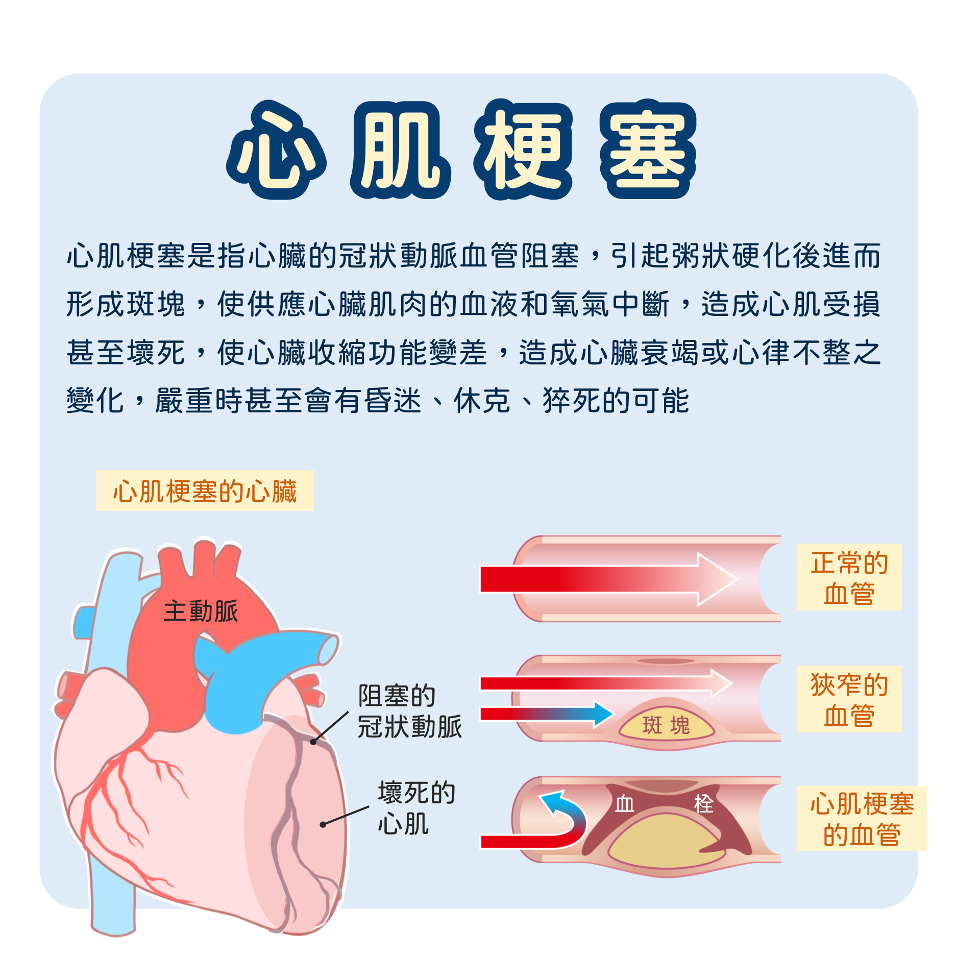 本頁圖片/檔案 - 03心血管分析