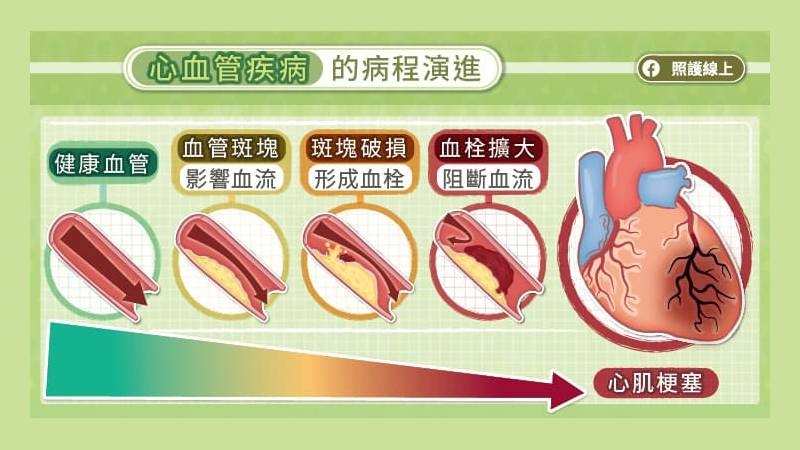 本頁圖片/檔案 - 心血管